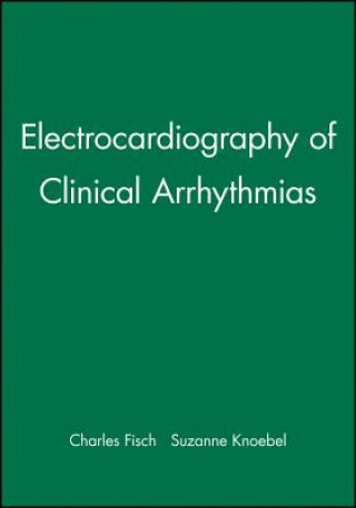 Electrocardiography of Clinical Arrhythmias