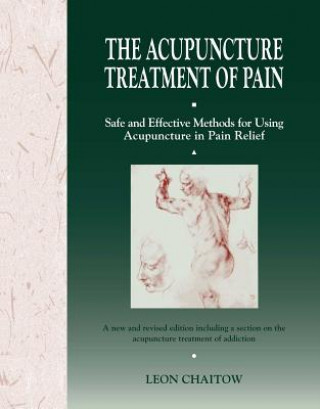 Acupuncture Treatment of Pain
