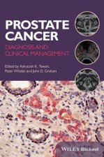 Prostate Cancer - Diagnosis and Clinical Management