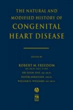 Natural and Modified History of Congenital Heart Disease