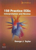 150 Practice ECGs - Interpretation and Review 3e