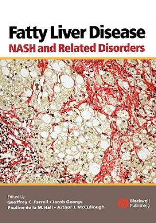 Fatty Liver Disease - NASH and Related Disorders