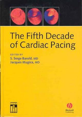 Fifth Decade of Cardiac Pacing