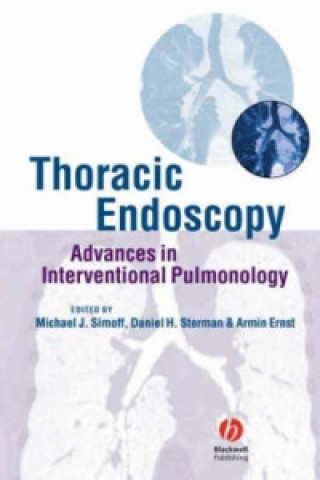Thoracic Endoscopy - Advances in Interventional Pulmonology