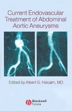 Current Endovascular Treatment of Abdominal Aortic Aneurysms