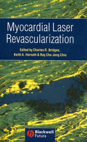 Myocardial Laser Revascularization
