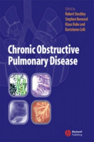 Chronic Obstructive Pulmonary Disease