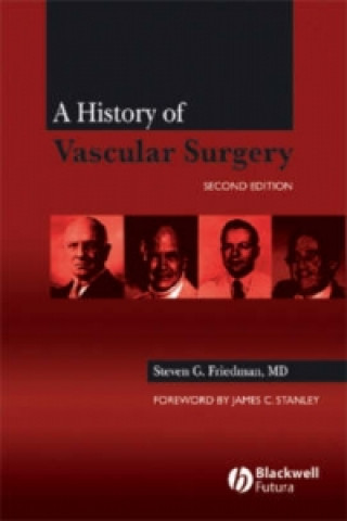 History of Vascular Surgery 2e