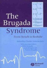 Brugada Syndrome - From Bench to Bedside