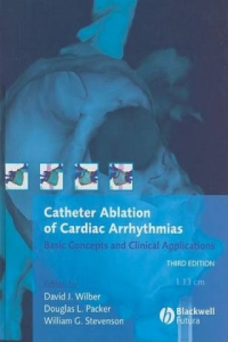 Catheter Ablation of Cardiac Arrhythmias - Basic Concepts and Clinical Applications 3e