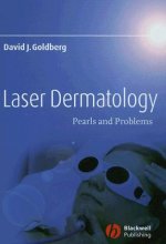 Laser Dermatology