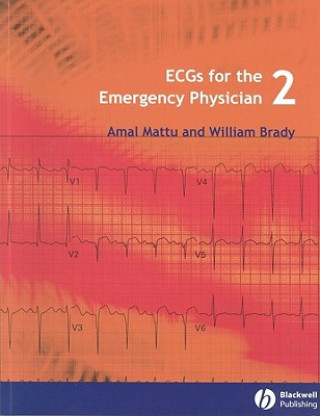 ECGs for the Emergency Physician 2e
