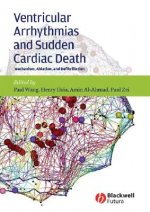 Ventricular Arrhythmias and Sudden Cardiac Death -  Mechanism, Ablation and Defibrillation