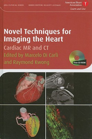 Novel Techniques for Imaging the Heart - Cardiac MR and CT