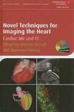 Novel Techniques for Imaging the Heart - Cardiac MR and CT