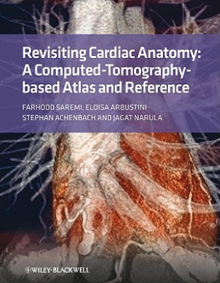Revisiting Cardiac Anatomy - A Computed-Tomography - Based Atlas and Reference