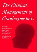 Clinical Management of Craniosynostosis