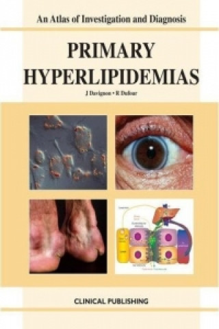 Primary Hyperlipidemias