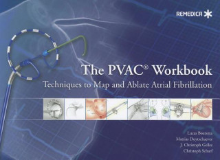 PVAC(R) Workbook: Techniques to Map and Ablate Atrial Fibrillation