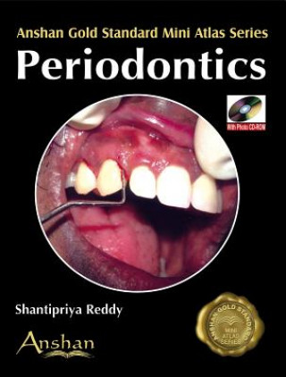Mini Atlas of Periodontics