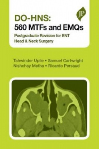 DO-HNS: 560 MTFs and EMQs