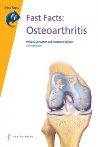 Fast Facts: Osteoarthritis