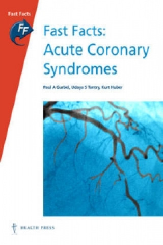 Fast Facts: Acute Coronary Syndromes