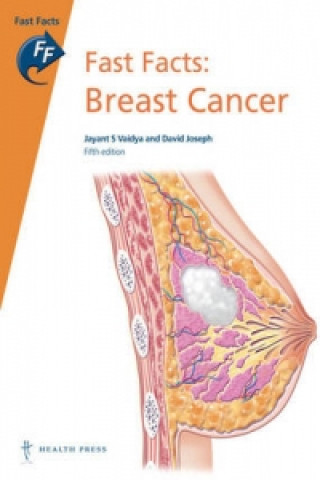 Fast Facts: Breast Cancer