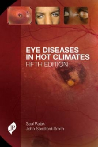 Eye Diseases in Hot Climates