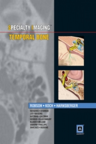 Specialty Imaging: Temporal Bone