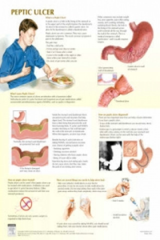 Peptic Ulcer Chart