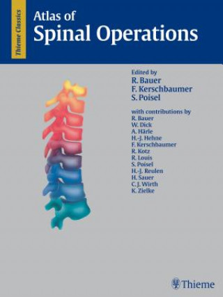 Atlas of Spinal Operations