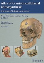 Atlas of Craniomaxillofacial Osteosynthesis