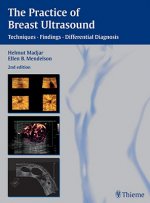 Practice of Breast Ultrasound