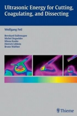 Ultrasonic Energy for Cutting, Coagulating, and Dissecting