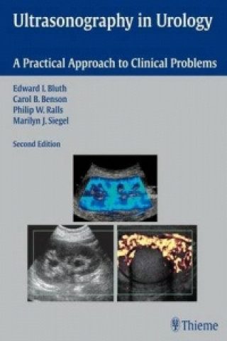 Ultrasonography in Urology