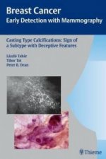 Casting-Type Calcifications: Sign of a Subtype with Deceptive Features