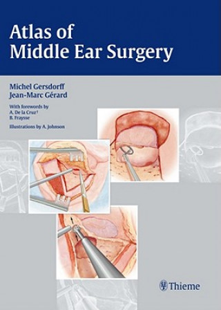 Atlas of Middle Ear Surgery