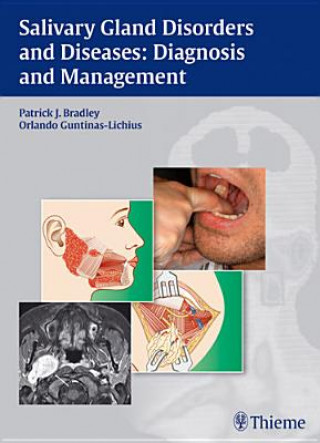 Salivary Gland Disorders and Diseases: