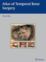 Atlas of Temporal Bone Surgery