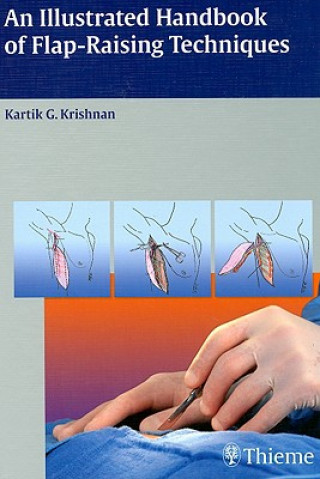 Illustrated Handbook of Flap-Raising Techniques