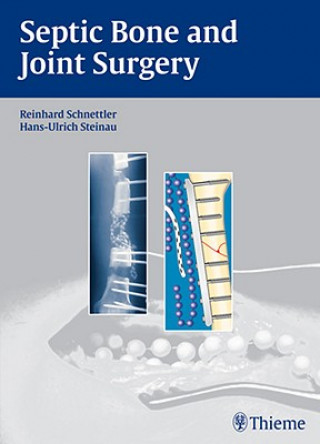 Septic Bone and Joint Surgery (Hans-Ulrich Steinau,Reinhard Schnettler)(Kemény kötésű)
