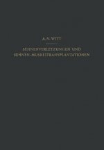 Sehnenverletzungen Und Sehnen-Muskeltransplantationen