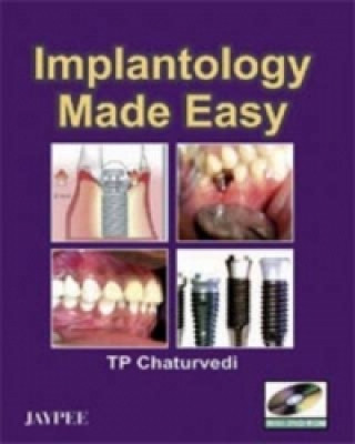 Implantology Made Easy