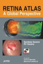 Retina Atlas - A Global Perspective