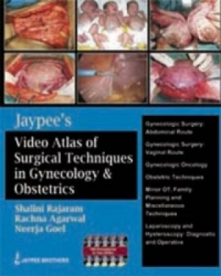 Jaypee's Video Atlas of Surgical Techniques in Gynecology and Obstetrics