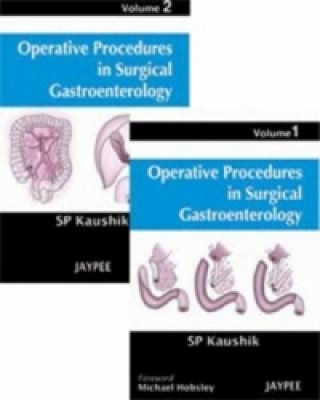 Operative Procedures in Surgical Gastroenterology