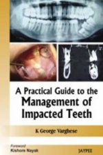 Practical Guide to the Management of Impacted Teeth