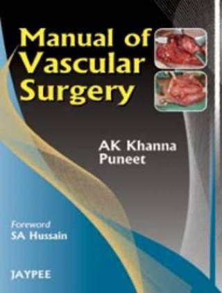 Manual of Vascular Surgery