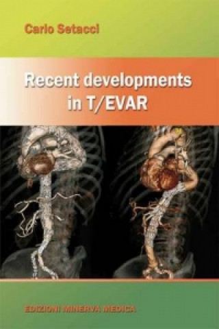 Recent Developments in T/EVAR